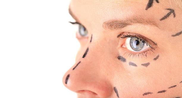 tratamiento de botox facial